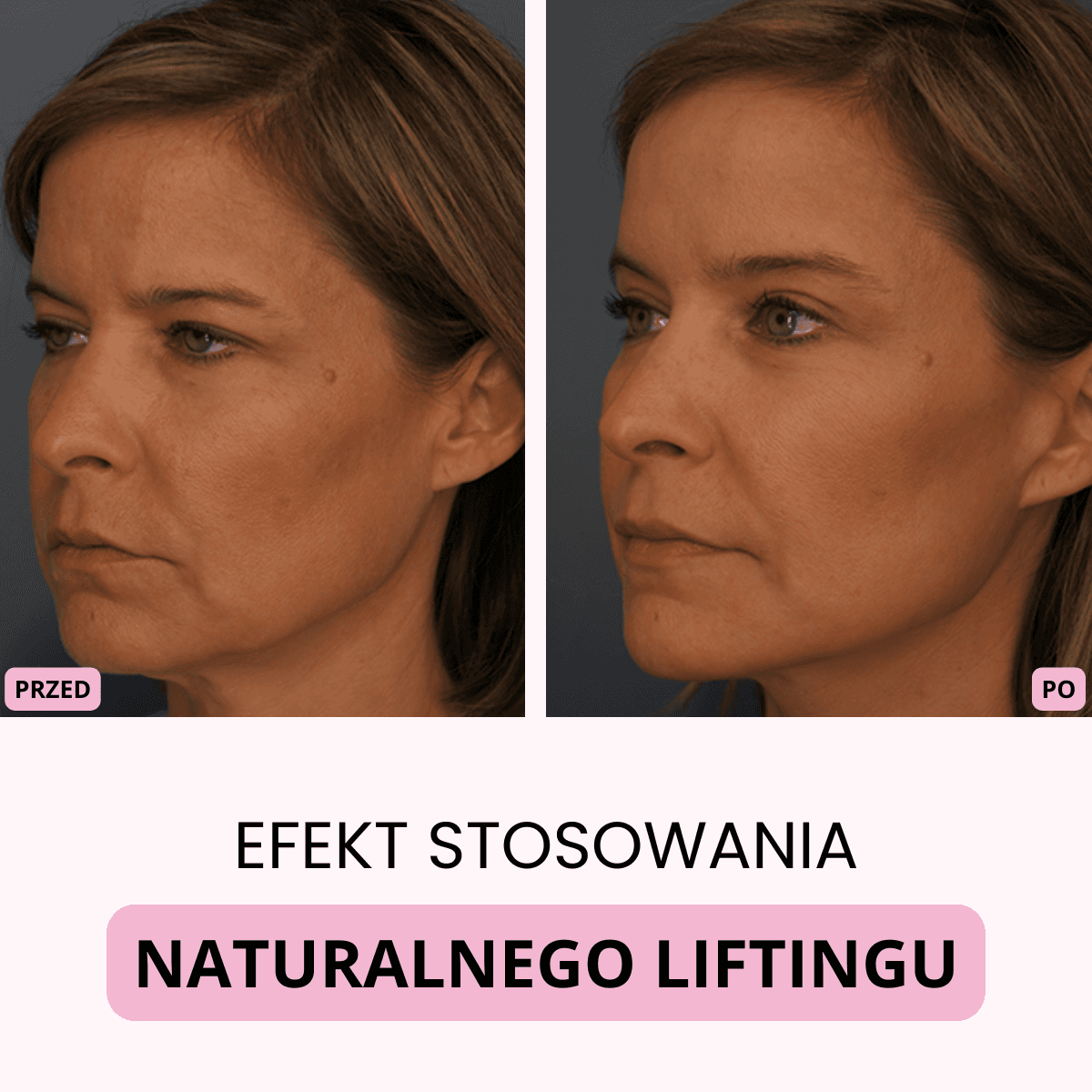 AERI – Naturalny lifting twarzy w 5 minut