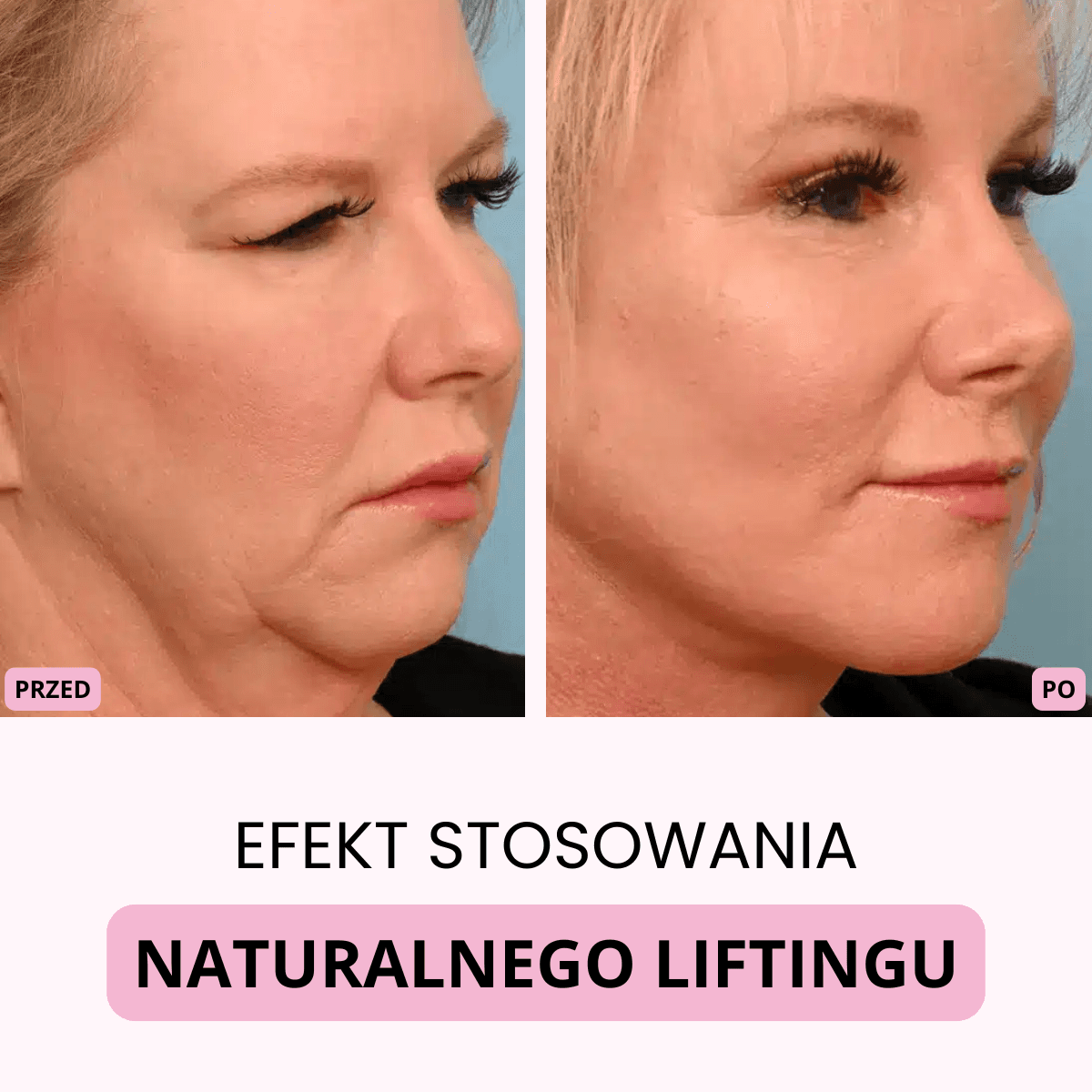 AERI – Naturalny lifting twarzy w 5 minut